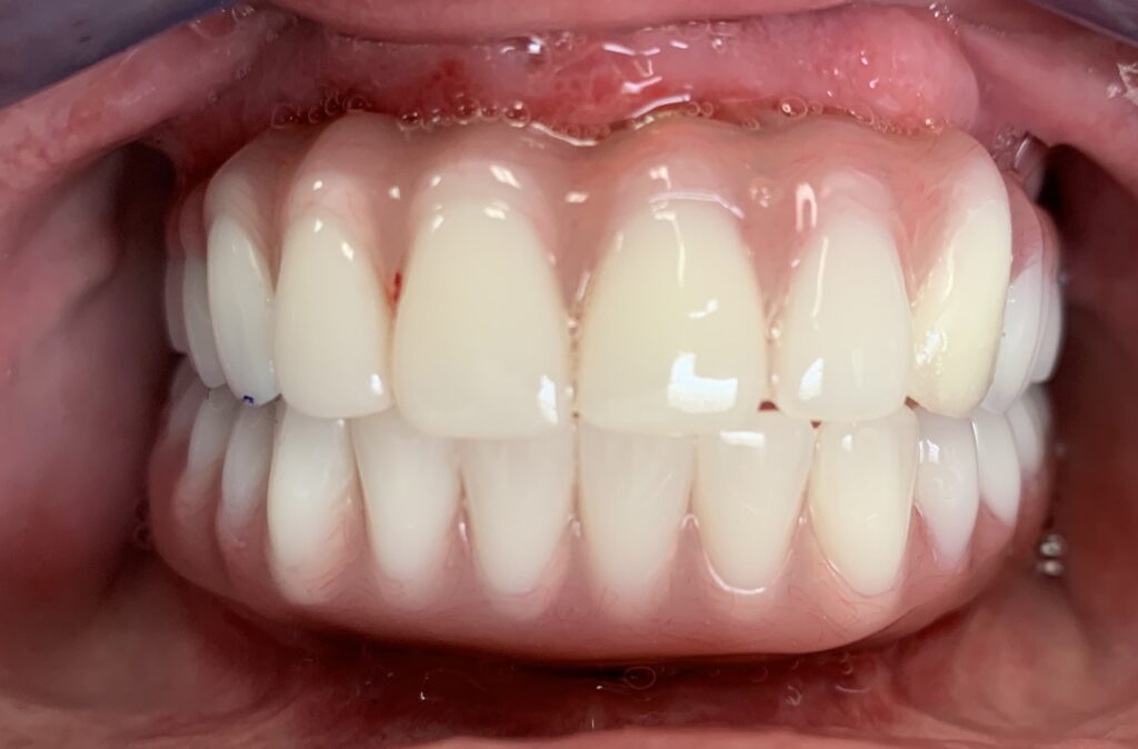 Photo of Before and After 2