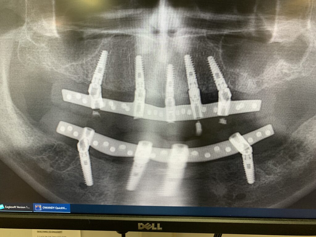 Photo of Before and After 3