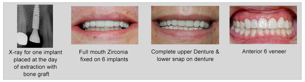 Photo of Before and After 9