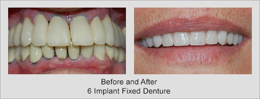 Photo of Before and After 7