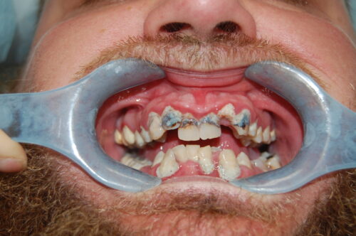 Photo of Before and After 1