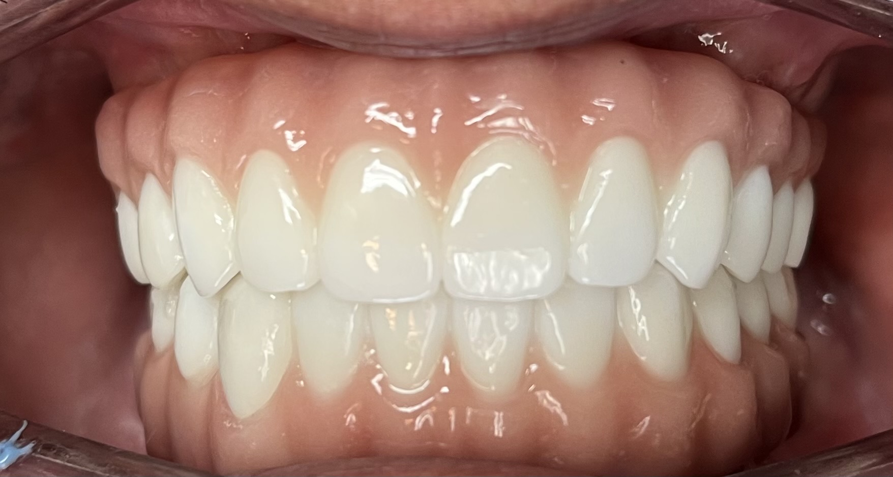 Photo of Before and After 19