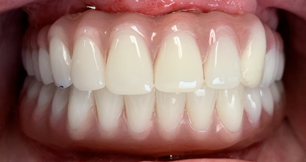 Photo of Before and After 2