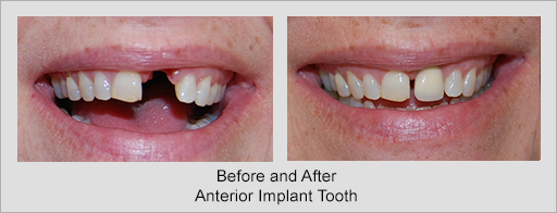 Photo of Before and After 8