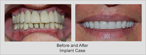 Photo of Before and After 18