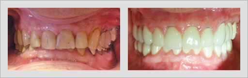 Photo of Before and After 17