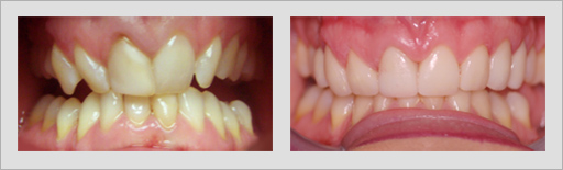 Photo of Before and After 6