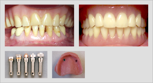 Photo of Before and After 3