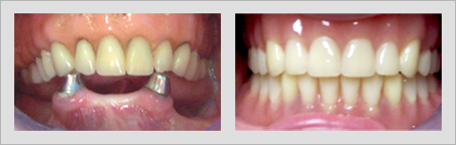 Photo of Before and After 5