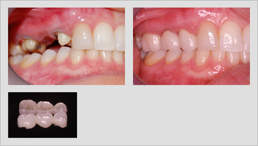 Photo of Before and After 15