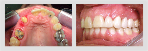 Photo of Before and After 4