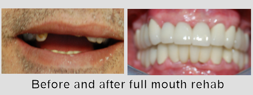 Photo of Before and After 10