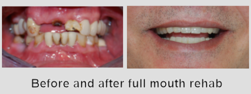 Photo of Before and After 19